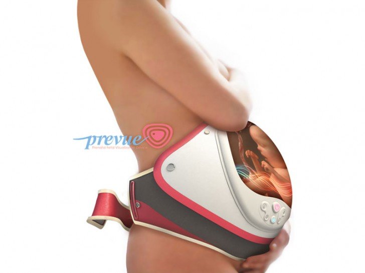 prevue 1